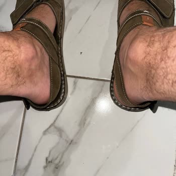 Derimod Sandaletin Cırtcırt Sorunu ve Müşteri Hizmetleri Cevabı