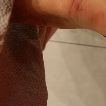 Lacoste Ayakkabı: 2 Ayda Parçalanan ve Yaralayan Ürün