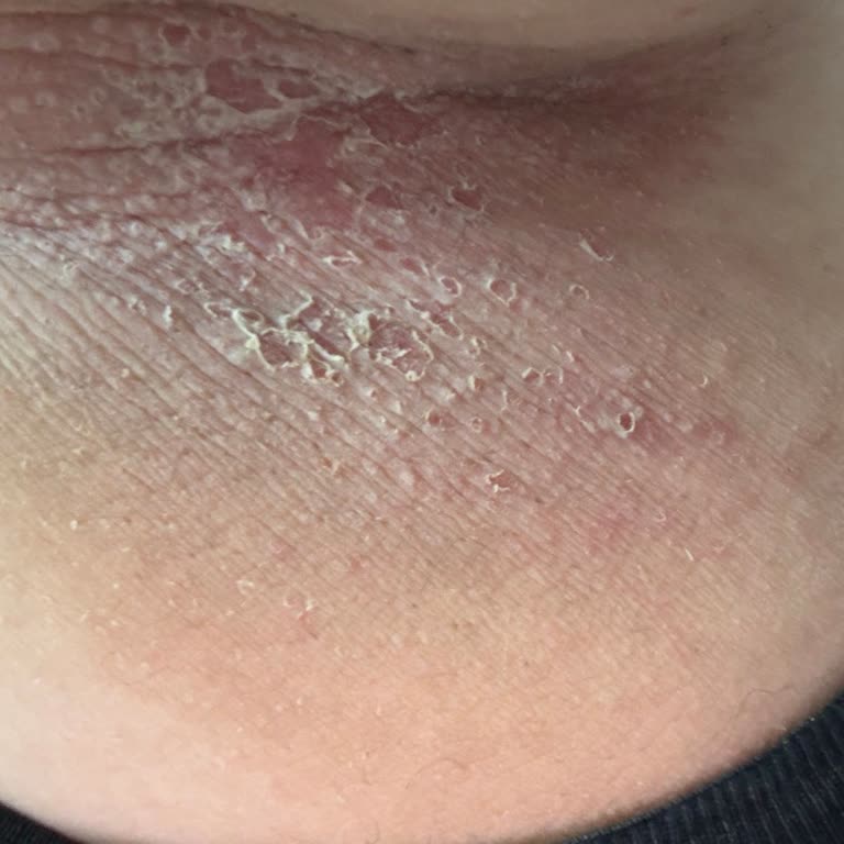 Spa Hizmetlerinde Yetersiz İlgi ve Kalitesiz Deneyim