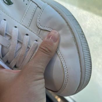 Lacoste Ayakkabının Kenarlarından Açılması ve İnceleme Süreci