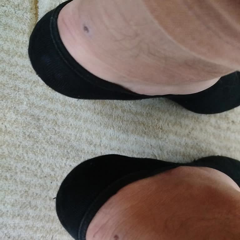 Ayakkabı Vurması ve Mağaza İlgisizliği