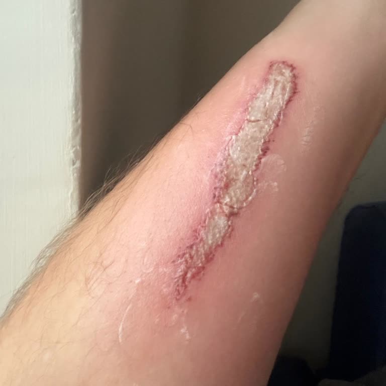 Aquapark Güvenlik Eksikliği ve İlgisiz Yönetim