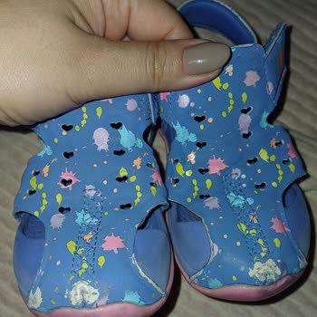 Sadece 1 Haftada Yıpranan Skechers Çocuk Sandaleti