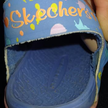 Sadece 1 Haftada Yıpranan Skechers Çocuk Sandaleti