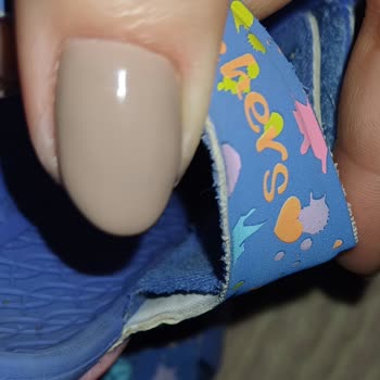 Sadece 1 Haftada Yıpranan Skechers Çocuk Sandaleti