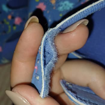 Sadece 1 Haftada Yıpranan Skechers Çocuk Sandaleti