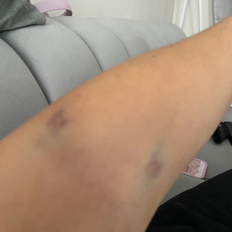 Sağlık Bakanlığı Kötü Muamele Ve İlgisizlik