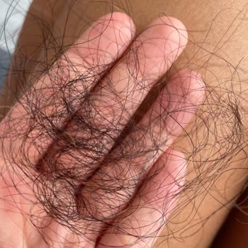 Sentetik Saç Sorunu ve İade Kabul Edilmiyor