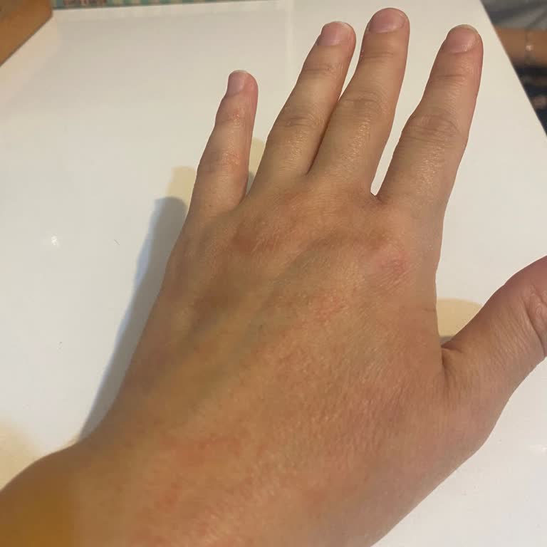 Cif Ultra Spreyi Cildimi Tahriş Etti