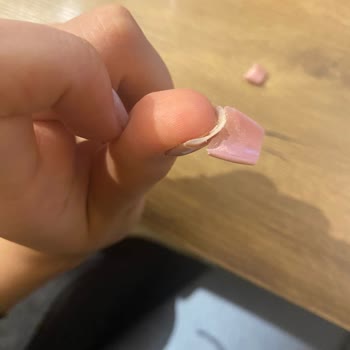 Randevu Sistemi ve Jel Uygulaması Mağduriyeti