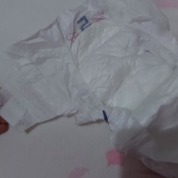 Bebek Bezlerinde Tekrarlayan Cırt Cırt Sorunu