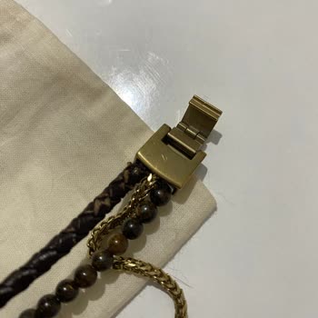 Fossil Marka Bilekliğin Deri Kısmı Hızla Deforme Oldu ve Garanti Sorunu Yaşandı