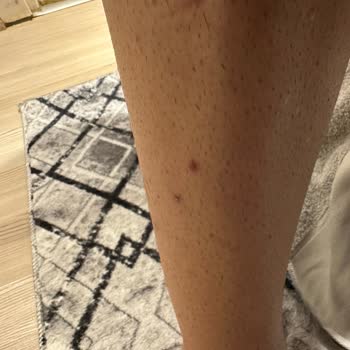 Philips Vücut Tıraş Makinesi Cildimi Mahvetti ve Kıllarımı Kalınlaştırdı