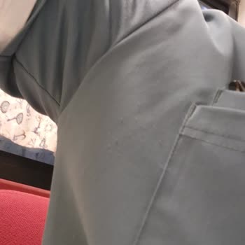 Notus Scrubs Tüylenme ve Müşteri Hizmetleri Sorunu