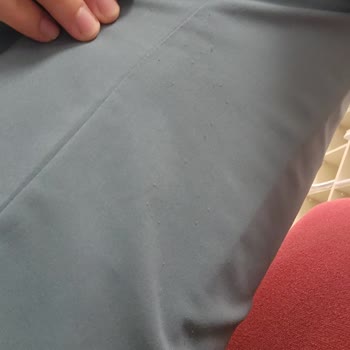 Notus Scrubs Tüylenme ve Müşteri Hizmetleri Sorunu