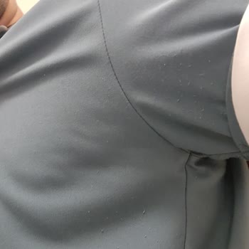 Notus Scrubs Tüylenme ve Müşteri Hizmetleri Sorunu