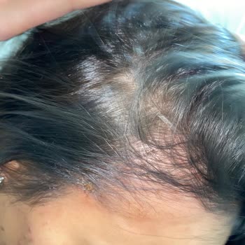 Saloon Oğuzhan Bosna Makas Tutmayı Bilmiyor!