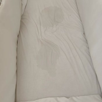 Sleepy Bebek Bezi Sızıntı Sorunu ve Maddi Yük