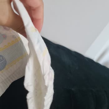 Molfix Bebek Bezlerinde Kalite Sorunu ve Sızıntı Problemi