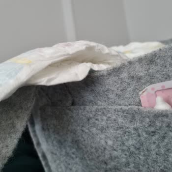 Molfix Bebek Bezlerinde Kalite Sorunu ve Sızıntı Problemi