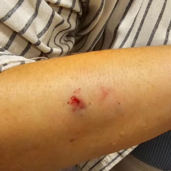 Tlos Butik Otel Otel Sahiplerin Köpeği Saldırdı