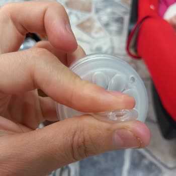 Philips Avent Biberon Ucu Sorunu