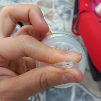 Philips Avent Biberon Ucu Sorunu