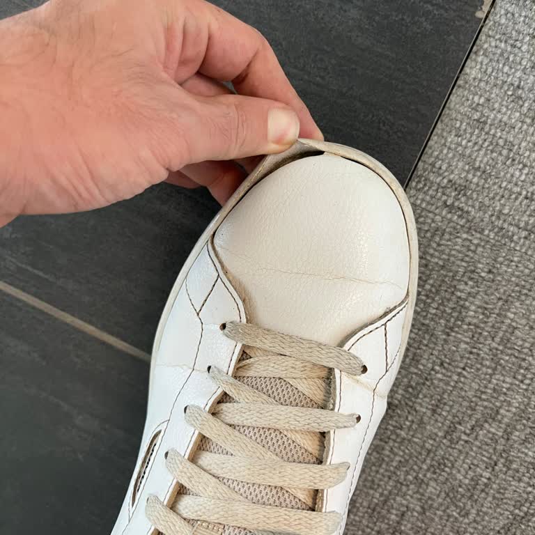 Orijinal Adidas Ayakkabının 5 Ayda Yırtılması ve Garanti Sorunu