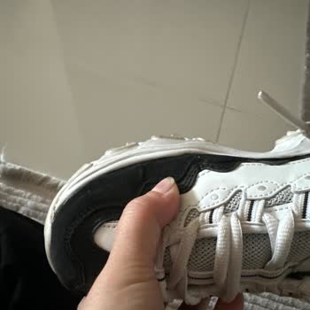 Skechers Ayakkabı Patladı A101 Destek Vermiyor