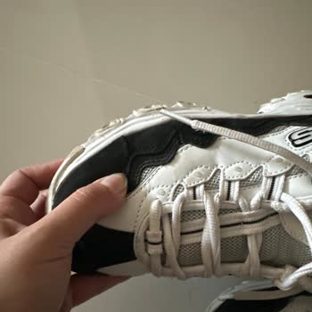 Skechers Ayakkabı Patladı A101 Destek Vermiyor