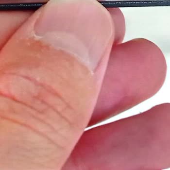 Vestel TV'de Çerçeve Sorunu ve Çözüm Arayışındaki Hayal Kırıklığı