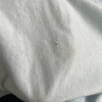 Electrolux Çamaşır Makinesi Sorunu: Delinen Giysiler