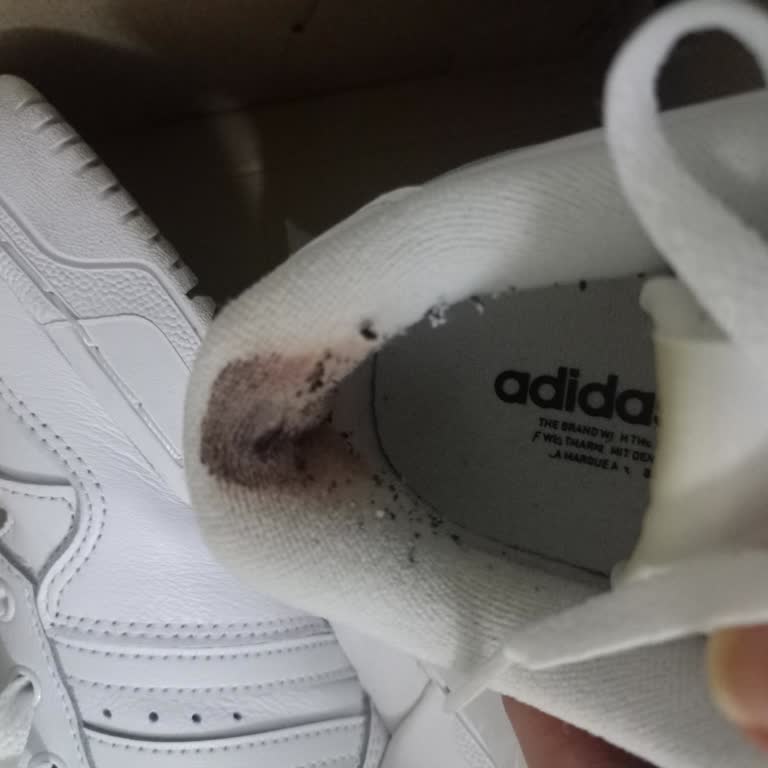 Adidas Ayakkabı Ayaklarımı Parçaladı