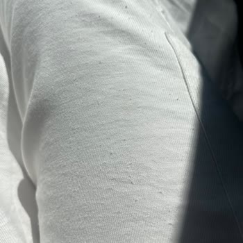 Müşteri Memnuniyeti Sıfır: Garantisiz Pantolon ve İlgisiz Hizmet