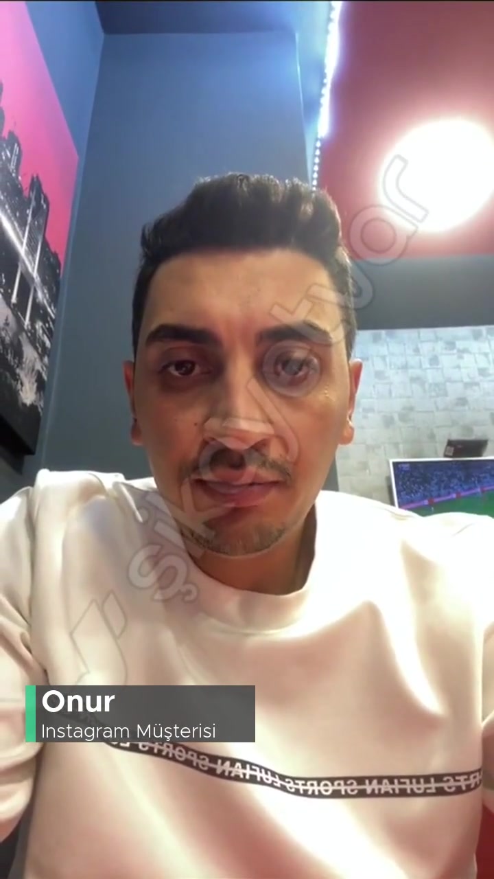 Instagram Taklit Ediyor videonun kapak resmi