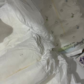 Sleepy Bebek Bezlerinde Kalite Sorunu