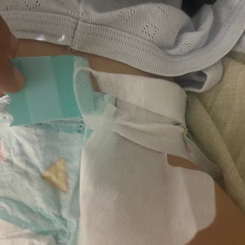 Prima Bebek Bezlerinde Kalite Sorunu