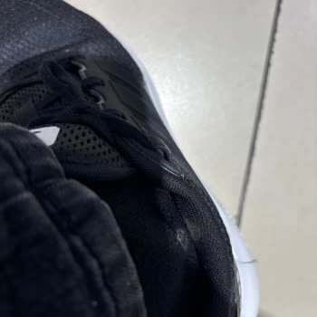 Adidas Ayakkabı Ayağımı Mahvetti!