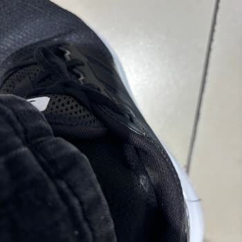 Adidas Ayakkabı Ayağımı Mahvetti!