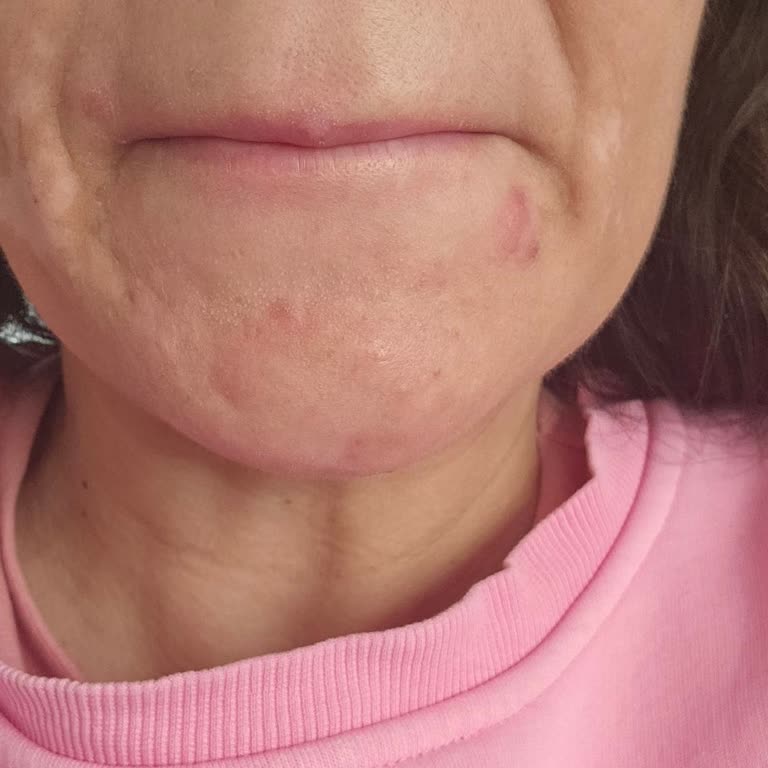 Şevval Turan Beauty Baştan Savma Yapılan İşlem!