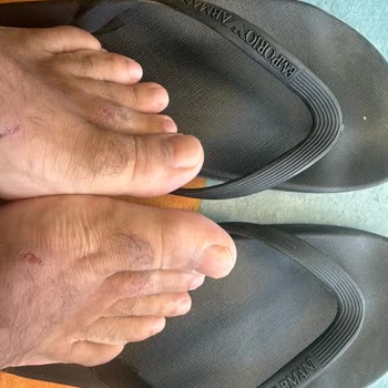 Hayal Kırıklığı Yaratan Terlik Deneyimi