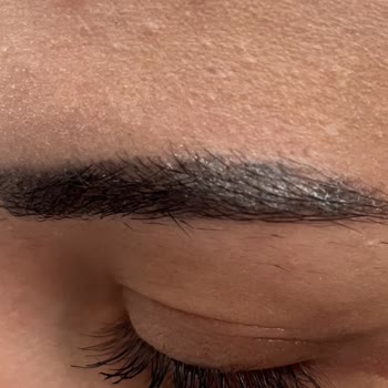 Kötü Kaş Deneyimi ve Ücret İadesi Talebi