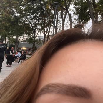 Kötü Kaş Deneyimi ve Ücret İadesi Talebi