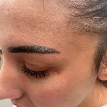 Kötü Kaş Deneyimi ve Ücret İadesi Talebi