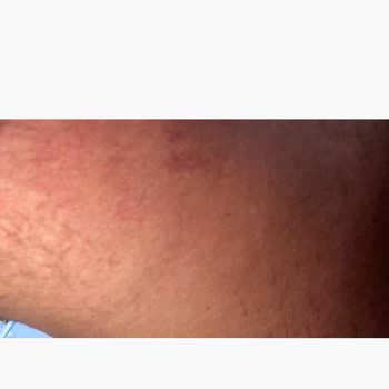 Cilt Sorunları ve İlgisiz Müşteri Hizmeti