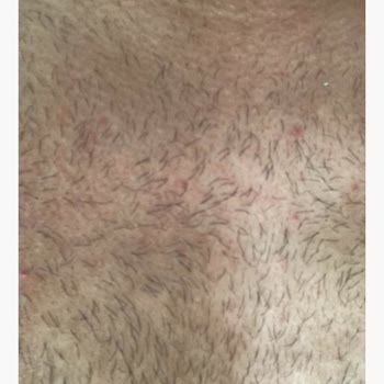 Cilt Sorunları ve İlgisiz Müşteri Hizmeti