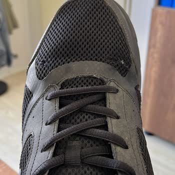 Skechers Ayakkabıda Beklenmedik Deformasyon Ve Hayal Kırıklığı