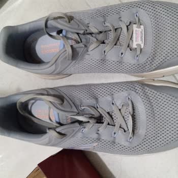 Skechers Ayakkabıda Beklenmedik Deformasyon Sorunu