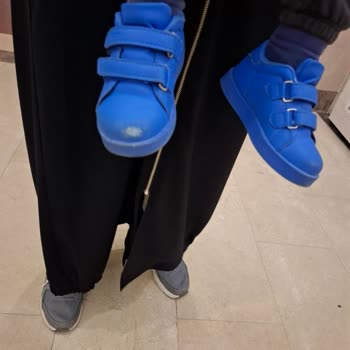 Çocuk Ayakkabısında 9 Gün İçinde Soyulma ve Şekil Bozukluğu