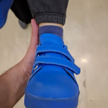 Çocuk Ayakkabısında 9 Gün İçinde Soyulma ve Şekil Bozukluğu